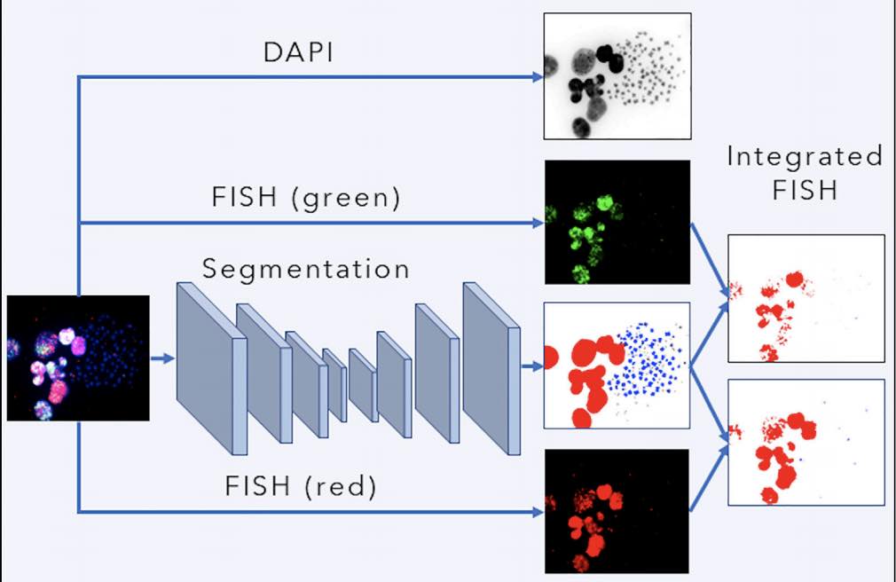 EcSeg: Semantic Segmentation of Metaphase Images Containing Extrachromosomal DNA