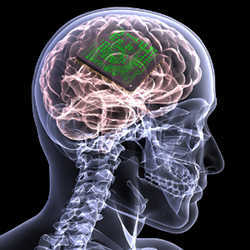 Neuro
